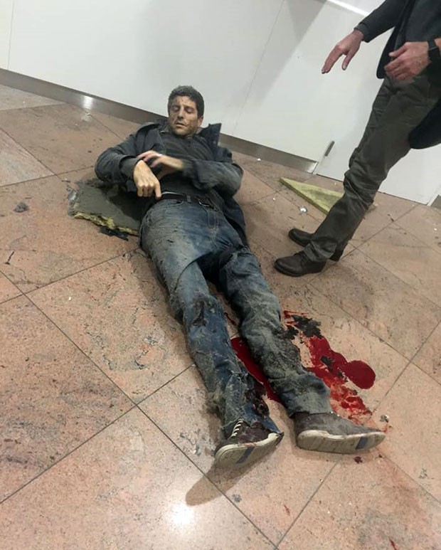 Ex-jogador de basquete brasileiro ficou ferido em atentado na Bélgica (Foto: Ketevan Kardava/ Georgian Public Broadcaster/AP)