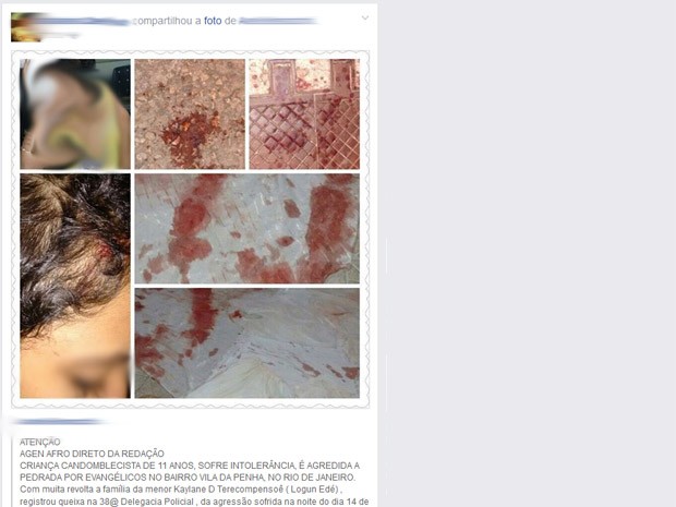 Criança vítima de intolerância religiosa ficou com cicatriz (Foto: Reprodução/Facebook)