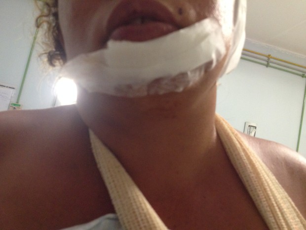 Vítima tem ferimentos no rosto e por pouco não morreu (Foto: Gilcilene Araújo/G1)