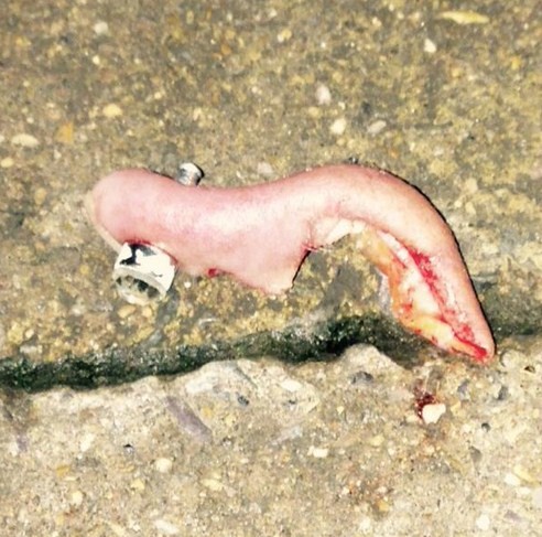 Resultado de imagem para PEDAÇO DE ORELHA