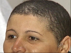Moradora de Sorocaba, SP, fica careca após usar alisante (Foto: Reprodução TV Tem)