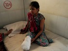 Mulher que sobreviveu à tragédia em Bangladesh tem perna amputada