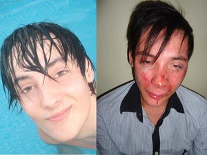 André Barbosa afirma ter sido agredido após beijar rapaz (Foto: André Barbosa/Arquivo Pessoal)