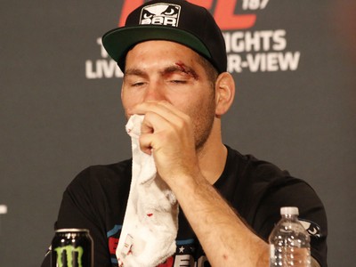 Chris Weidman UFC 187 coletiva de imprensa (Foto: Evelyn Rodrigues)