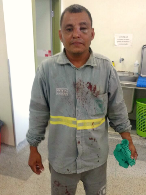 James Serra, 44 anos, foi agredido nesta quarta-feira (20) após cortar desvio clandestino de energia em bairro de Rio Branco (Foto: Bruno Alencar/Arquivo Pessoal)