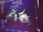 Perlla posta foto do ultrassom da sua segunda filha