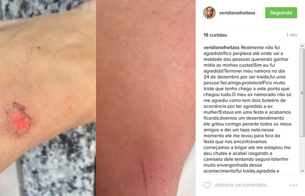 Veridiana Freitas publica supostas agressões (Foto: Reprodução/Instagram)