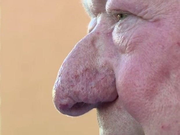 Golandês Hans Roest venceu o campeonato de maior nariz do mundo (Foto: Reprodução/YouTube/Ruptly TV)