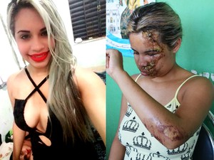 Jovem atropela a ex e a mãe dela e é preso por tentativa de homicídio no Amapá (Foto: Biianca Santos/Arquivo Pessoal; Jorge Abreu/G1)
