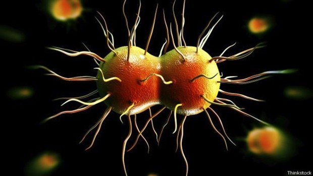 A vaginose bacteriana pode levar a outras doenças sexualmente transmissíveis, como a gonorreia  (Foto: Thinkstock/BBC)