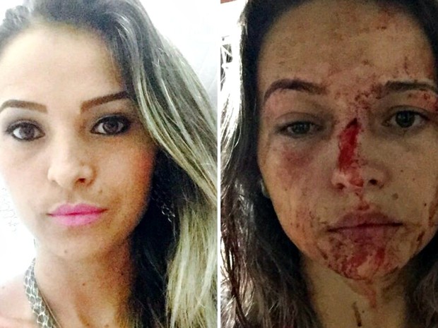 Pamela antes e depois de ter sido agredida pelo lutador de MMA durante invasão na casa da amiga  (Foto: Milliane Silva/Arquivo pessoal)
