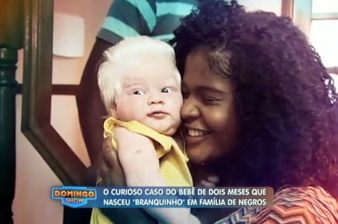 O caso do bebê albino mostrado no Domingo show (Foto: Reprodução)