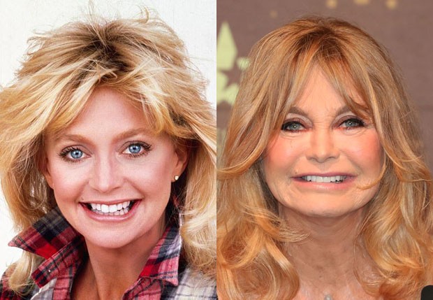 Goldie Hawn em 1987 e em 2016 (Foto: Reprodução e Scott Barbour/Getty Images) Goldie Hawn em 1987 e em 2016 (Foto: Reprodução e Scott Barbour/Getty Images)