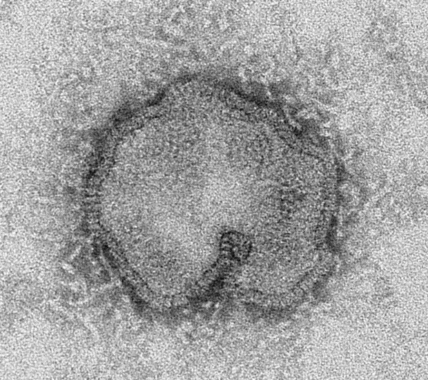 Visto por microscópio, vírus H7N9 pode assumir diversas formas, afirma o Centro de Prevenção e Controle de Doenças dos EUA (CDC, na sigla em inglês) (Foto: C.S. Goldsmith/CDC/AP)