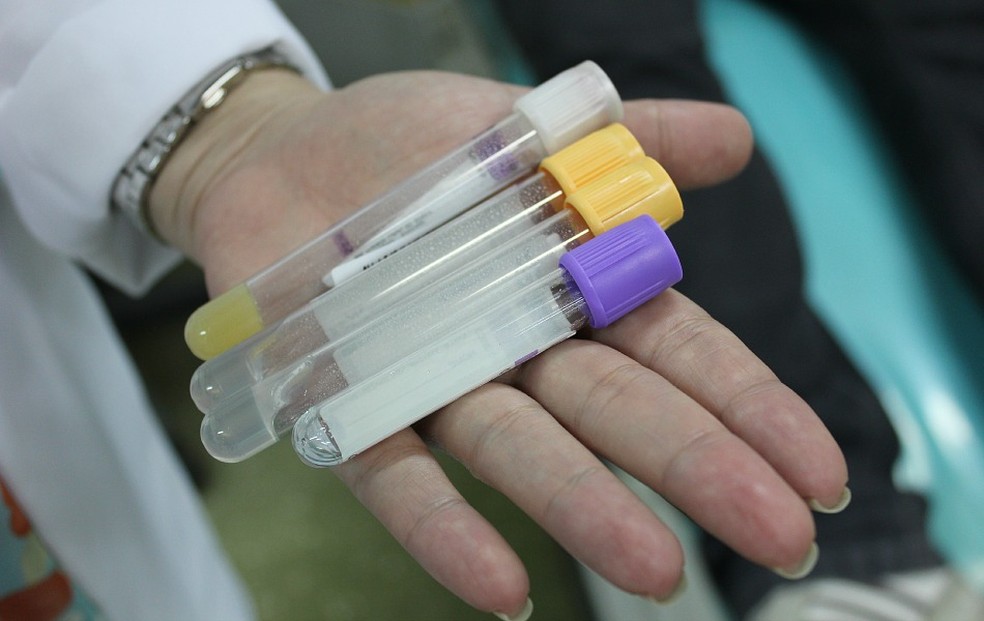 Teste rápidos para diagnosticar o HIV serão realizados (Foto: Girlene Medeiros / G1 AM)