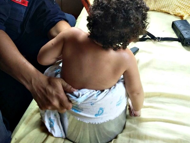 Menina de um ano e oito meses ficou presa à panela de pressão  (Foto: Divulgação/Bombeiros)