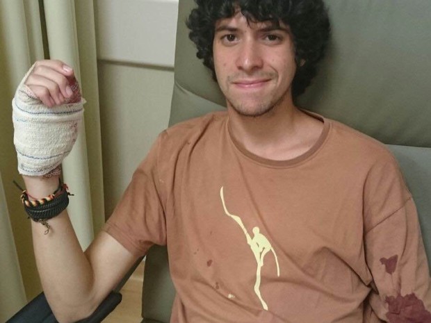 Estudante Gustavo ferido na mão (Foto: Arquivo Pessoal)