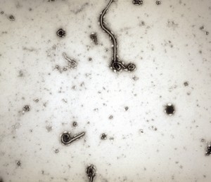 Foto divulgada pelo Instituto de Doenças Tropicais da Antuérpia, Bélgica, mostra vírus ebola visto pelo microscópio (Foto: Antwerp Institute of Tropical Medicine/AP)