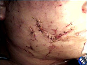 Rosto de mulher atacada por onça foi muito machucado. (Foto: Reprodução / TV Liberal)