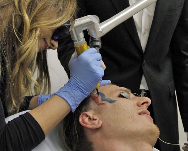 Eric Hartsburg, um lutador de Indiana, nos EUA, passa por procedimento para remover a tatuagem que fez com o logotipo da campanha do republicano Mitt Romney, para as eleições presidenciais deste ano  (Foto: Nick Ut/AP)