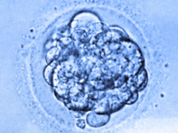 Imagem de microscópio mostra um blastocisto, embrião humano de uma semana (Foto: Flickr.com/gloryfish - CC)