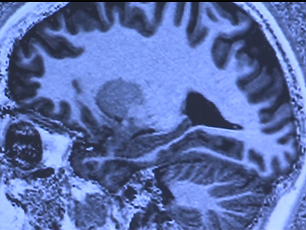 Pesquisadores usaram exames de ressonância magnética funcional do cérebro (Foto: University of Utah Health Sciences)
