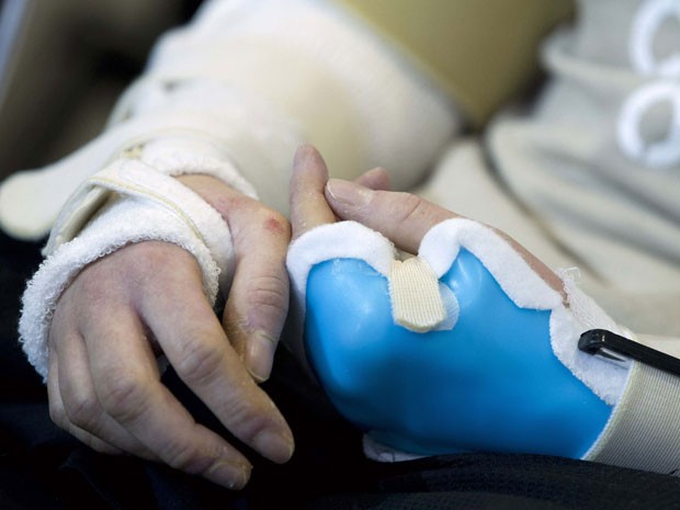 O ex-soldado norte-americano xxx  Marrocco junto a médicos que participaram da cirurgia de transplante de braços (Foto: Jose Luis Magana/Reuters)