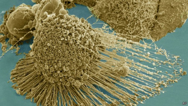Pesquisa pode ajudar a desenvolver novos tratamentos contra o câncer. (Foto: BBC)