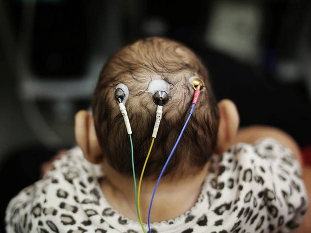 Com microcefalia, um dos filhos gêmeos de 5 meses de idade de Jaqueline Jéssica Silva de Oliveira passa por exame na USP, em São Paulo. Os bebês foram identificados como um caso raro em que um deles nasceu com microcefalia, e o outro, não (Foto: Nacho Doce/Reuters)