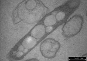 Imagem da bactéria 'Delftia acidovorans' (Foto: Divulgação/Ecobiomaterial Research Lab/Universiti Sains Malaysia)