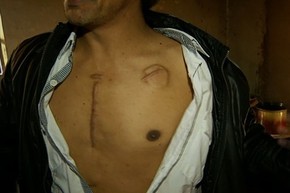 Polícia fecha clínicas de recuperação suspeitas de enterrar pacientes vivos, em Anápolis (Foto: Reprodução/TV Anhanguera)