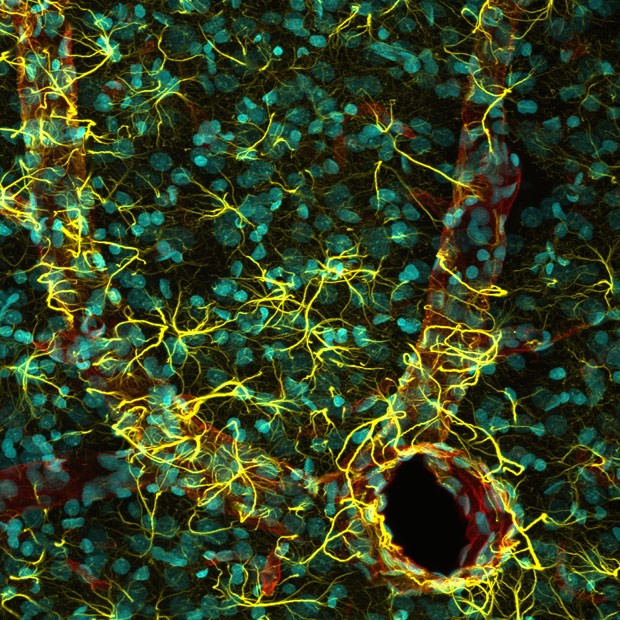  Fragmento de cérebro de rato mostram núcleos celulares (azul), astrócitos (amarelo) e vasos sanguíneos (verde) (Foto: Madelyn May/ 5º lugar no 2014 Olympus BioScapes Digital Imaging Competition/www.OlympusBioScapes.com )