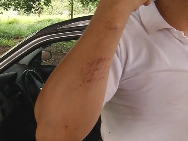 Homem mostra ferimentos provocados pelos assaltantes (Foto: Repdrodução/TV TEM)