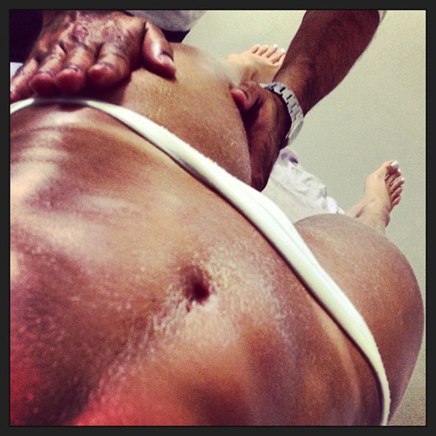Graciella Carvalho posta foto recebendo massagem (Foto: Instagram / Reprodução)