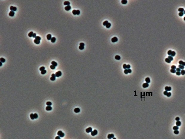 Essas bactérias (Tersicoccus phoenicis) recém-descobertas são conhecidas como micróbios do quarto limpo, porque resistem a esterilizações em alguns locais (Foto: Leibniz_institute DSMZ/Jet Propulsion/Laboratory Caltech/BBC)