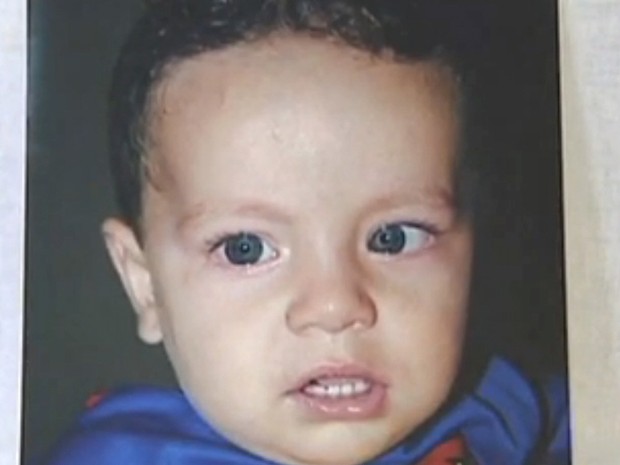 Criança câncer olho Taubaté (Foto: Reprodução/TV Vanguarda)