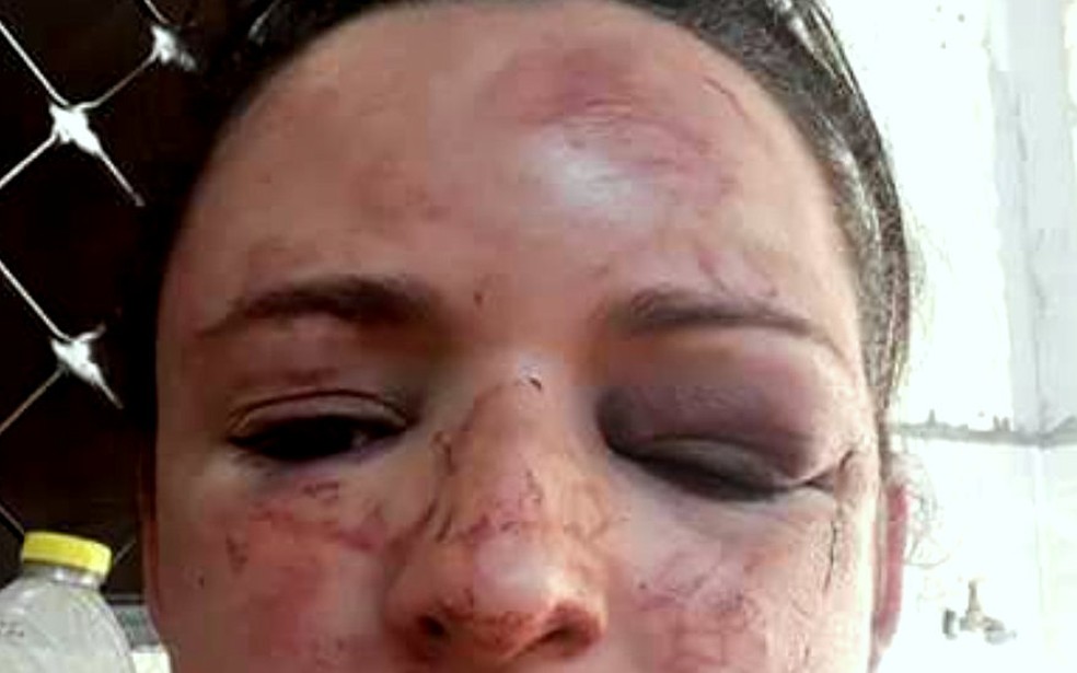 Mulher foi espancada por ex em Capivari (Foto: Vanessa Capelupi/Arquivo pessoal)