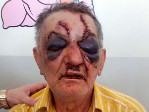 Idoso de 74 anos leva 40 pontos no rosto após espancamento na Bahia (Foto: Arquivo Pessoal)