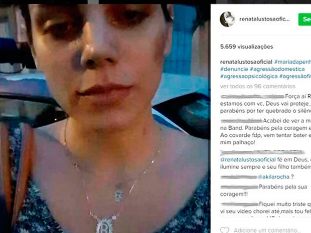 Ex-miss Piauí denunciou ex-marido de agressão e postou vídeo nas redes sociais (Foto: Reprodução/Instagram)