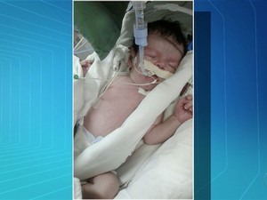 Bebê morre à espera de cirurgia (Foto: Reprodução/TV Anhanguera)