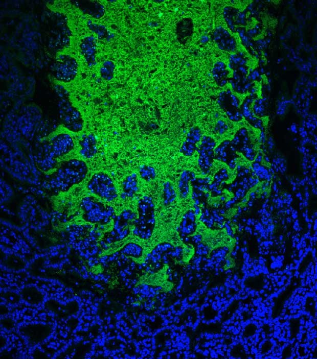 A imagem microscópica mostra o crescimento das bactérias para além do intestino, durante a infecção causada pelo 'Toxoplasma gondii' (Foto: Michael Molloy e Lily Koo; NIAID Biological Imaging Facility)