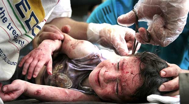 Uma menina de um ano e meio chora enquanto os médicos tentam remover os últimos pedaços de metal e material de construção de seu corpo. Um morteiro caiu dentro de sua casa (Foto: Javier Manzano) Uma menina de um ano e meio chora enquanto os médicos tentam remover os últimos pedaços de metal e material de construção de seu corpo. Um morteiro caiu dentro de sua casa (Foto: Javier Manzano)