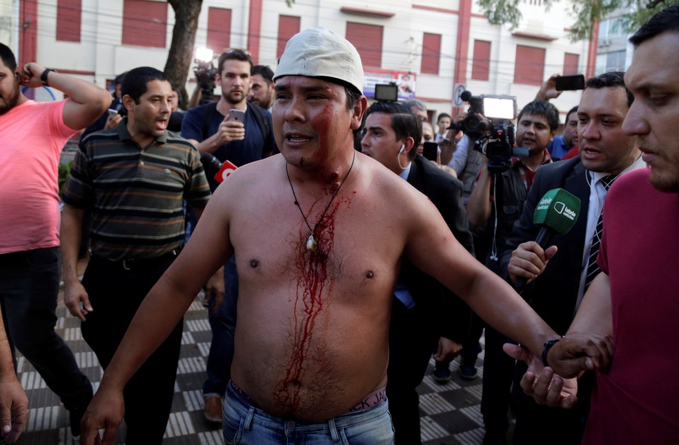 Manifestante é ferido por balas de borracha nesta sexta-feira durante protesto contra aprovação da reeleição presidencial no Paraguai (Foto: REUTERS/Jorge Adorno )