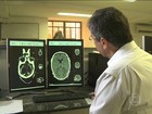 Secretaria de Saúde registra 11 novos casos de microcefalia no Sertão de PE