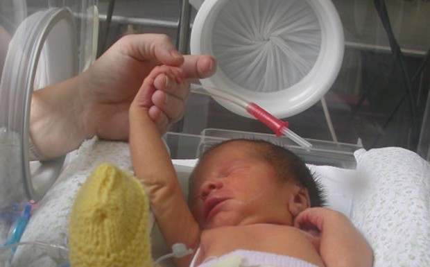 Pesquisas mostram que o contato da mãe com o bebê prematuro ajuda na recuperação (Foto: BBC)