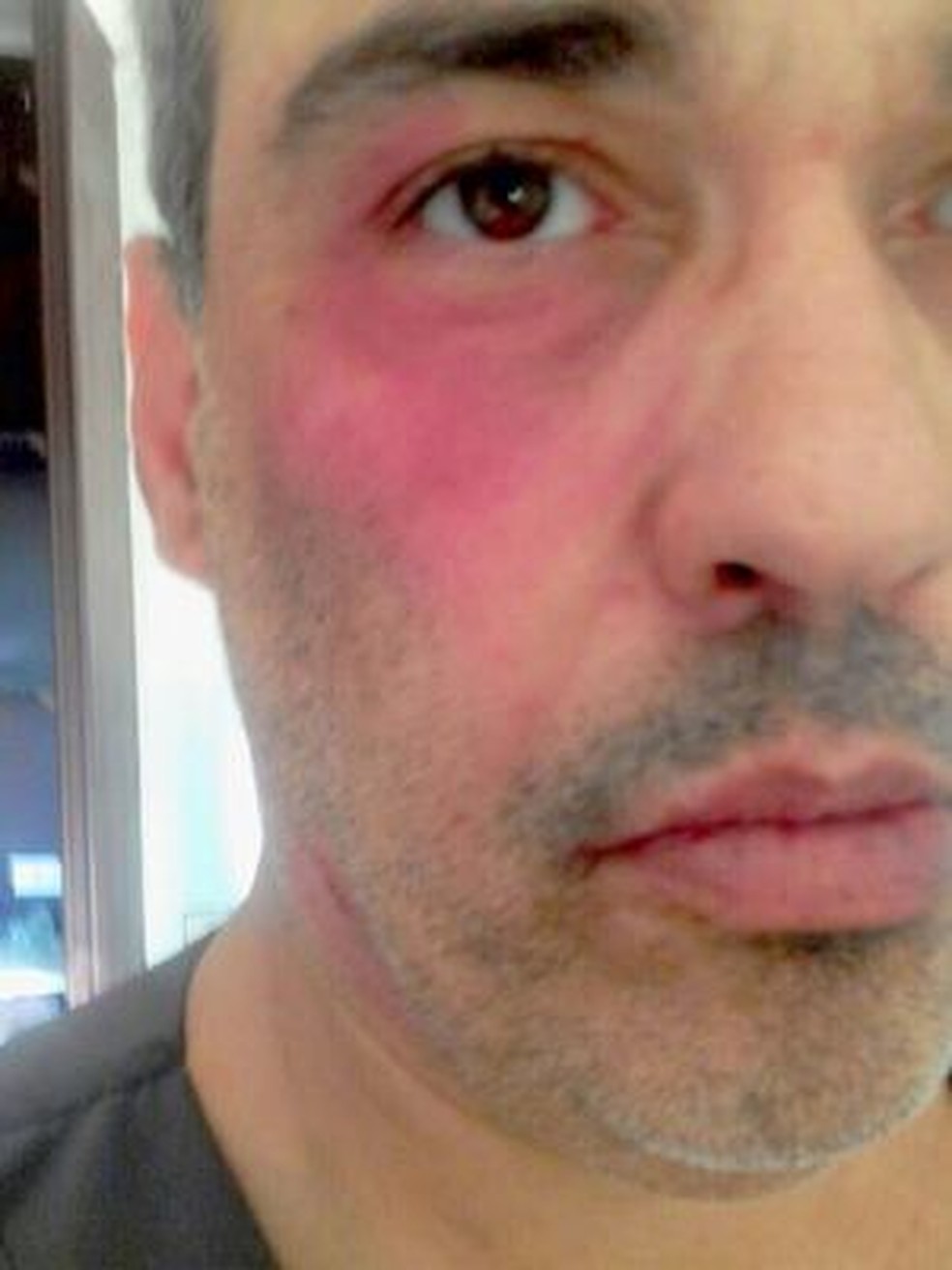 Médico foi agredido após negar atestado a paciente em Santa Bárbara (Foto: Arquivo Pessoal)
