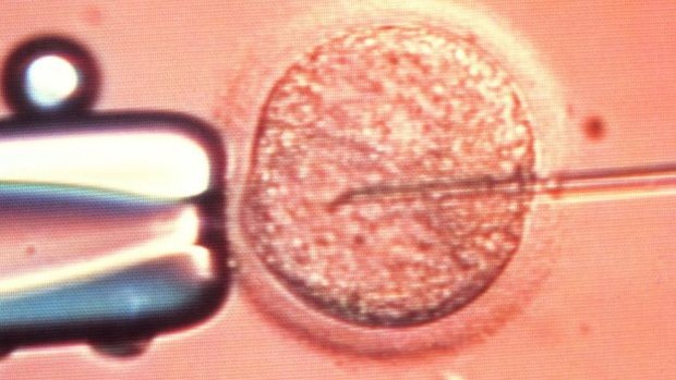 Família quer que óvulos sejam fecundados com sêmen de doador nos EUA  (Foto: Science Photo Library)