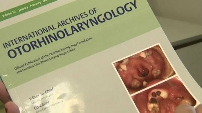 Medico Apresenta Tratamento Contra A Rinite Alergica Apos 10 Anos De Estudo Sorocaba E Jundiai G1 Peixes anchovy anchova/enchova, aquele peixe da pizza de alice. g1 globo