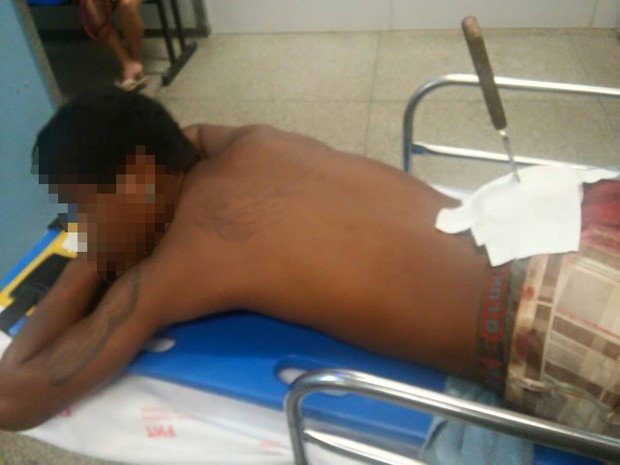 JOvem foi ficou com uma faca cravada nas costas, em Teresina 2 (Foto: Divulgao/Polcia Militar)