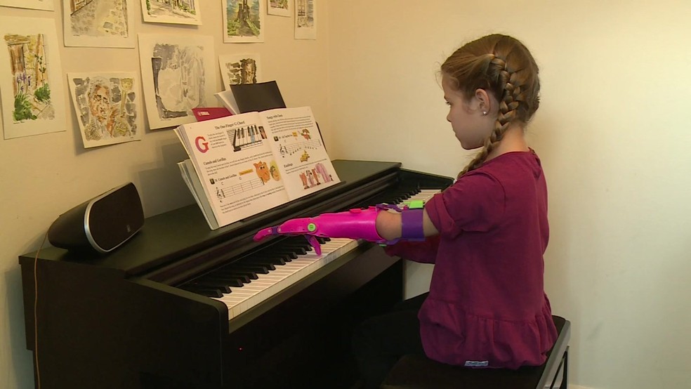 Próteses não são duradouras mas crianças crescem rápido e logo precisam de novos membros  (Foto: Reprodução)